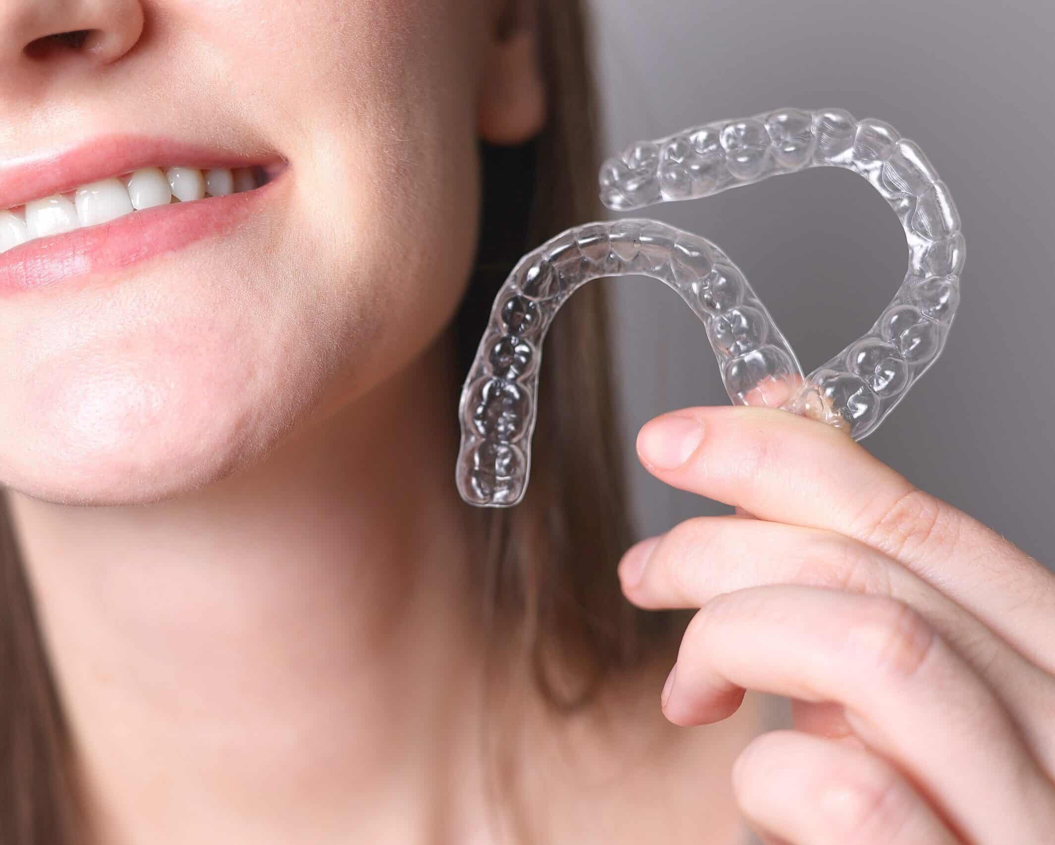 Aligners,For,Straightening,Teeth,In,A,Woman's,Hand